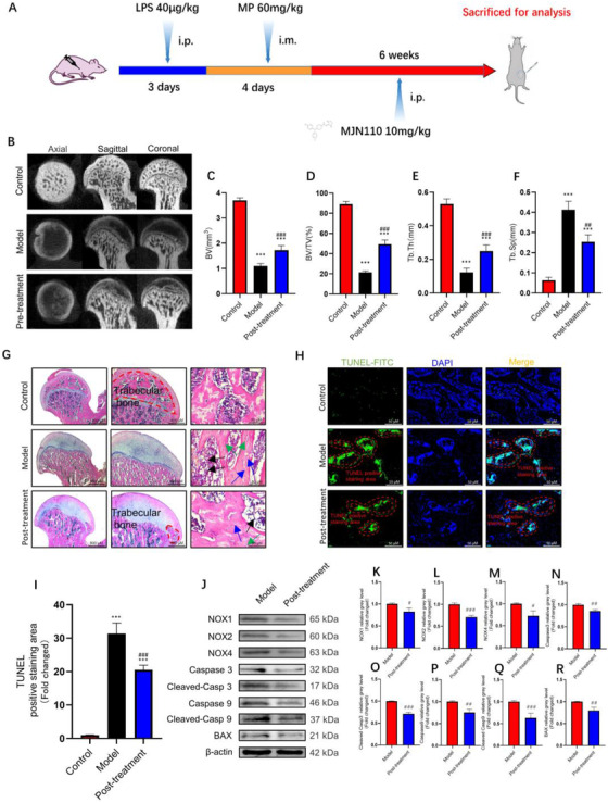 Monoacylglycerol lipase (MAGL) inhibitor can still alleviate osteonecrosis of the femoral head (ONFH) even after the initiation of GC‐induced oxidative stress. (A) The timeline of the GC‐induced ONFH model and administration of MJN110 in vivo. (B) Images of micro‐computed tomography (Micro‐CT). (C) Bone volume (BV). (D) Bone volume fraction (BV/TV). (E) Trabecular thickness (Tb.Th). (F) Trabecular spacing (Tb.Sp). (G) Hematoxylin and eosin (H&E) staining. (H) TUNEL staining of bone tissues. (I) Quantitative analysis of the area of TUNEL‐positive stains in (H). (J–R) The protein expression level of NADPH oxidative isozymes, apoptosis‐related proteins, and MAGL in bone tissues between model and posttreatment groups (n = 5, mean ± SD; *p < 0.05; **p < 0.01; ***p < 0.005 versus control group; #p < 0.05; ##p < 0.01; ###p < 0.005 versus MP group). Green arrows show nuclear pyknosis, blue arrows show empty osteocyte lacunae, and black arrows show fat droplets. All these studies were performed at least three biological replicates