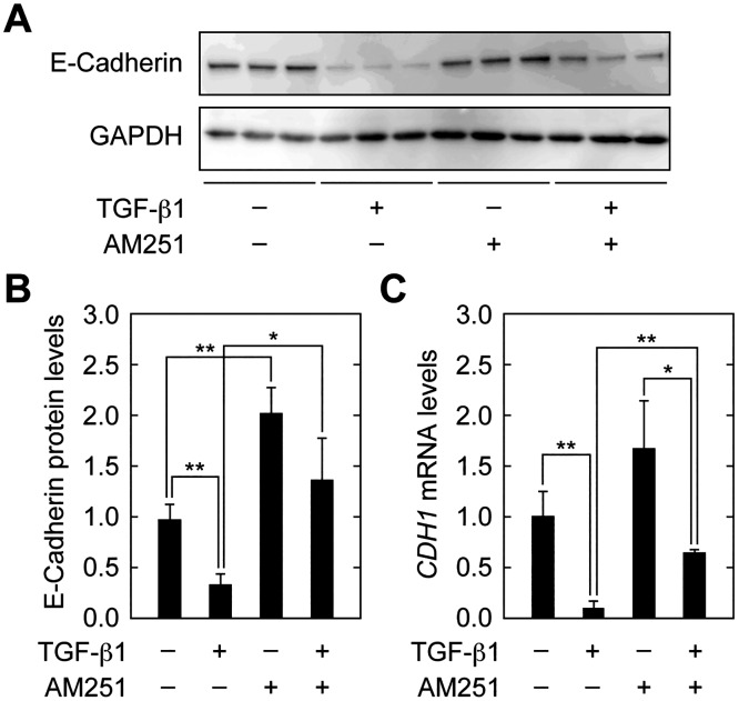 AM251 reverses TGF-β1-dependent decreases in E-cadherin expression.(A–C) RPTEC cells were incubated with 2 ng/ml TGF-β1 and/or 10 μM AM251, as indicated, for 24 h. (A) Total protein lysates were prepared and equal amounts of proteins (5 μg per sample) were separated by SDS-PAGE, followed by immunoblotting with an anti-E-cadherin antibody or an anti-GAPDH antibody as a loading control. (B) The results from (A) were quantified. Values are means ± SD of E-cadherin protein levels relative to those in cells with no treatment (TGF-β1(−) AM251(−)), from three independent experiments. (C) Total RNA was prepared and subjected to real-time RT-PCR to measure E-cadherin (CDH1) and PPIA mRNA levels. Values are means ± SD of the ratio of CDH1 to PPIA mRNA levels, expressed relative to the ratio in cells with no treatment (TGF-β1(−) AM251(−)), from three independent experiments. Statistically significant differences are indicated (* P < 0.05, ** P < 0.01, Student’s t-test).