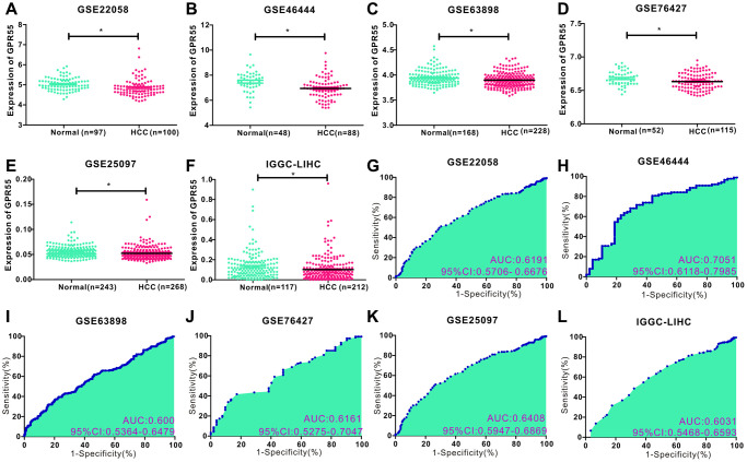 (A–F) Comparison of GPR55 expression in normal and tumor tissues in different HCC data sets (GSE22058, GSE46444, GSE63898, GSE76427, GSE25097, IGGC-LIHC) (*P < 0.05). (G–L) ROC diagnostic curve of GPR55 in different data sets.