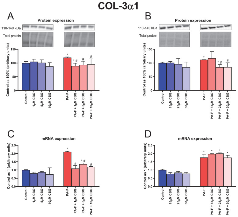 The influence of cannabigerol (CBG), in a concentration-dependent manner, on the collagen type 3 alpha 1 (COL-3α1) protein expression (A,B) and mRNA expression (C,D) in hepatocytes exposed to standard media (Control) or palmitate and fructose media (PA-F). The cells were treated with different concentrations of CBG for 48 h. The COL-3α1 protein and mRNA expression assays were performed using Western blot and RT-PCR techniques, respectively. The data are expressed as mean ± SD of six independent determinations and presented as a percentage of COL-3α1 changes relative to the Control (set as 100% for Western blot and as 1 for RT-PCR). Significant differences are indicated in comparison with the Control group (* p < 0.05) and PA-F group (# p < 0.05).