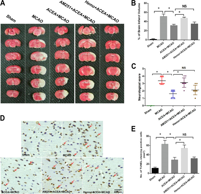 The cannabinoid CB1 receptor agonist ACEA reduced ischemic brain injury in rats.ATTC staining of rat brain slices. B The CB1 receptor antagonist AM251 reversed the ACEA-induced effect on brain infarct volume in rats. C AM251 reversed the ACEA-induced amelioration of neurological function in rats. D TUNEL staining of brain tissue. E AM251 reversed the ACEA-induced inhibition of cell apoptosis. Bar = 40 µm; *p < 0.05; NS no significance.