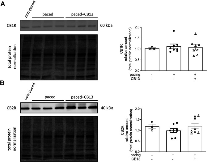 Cannabinoid receptor protein levels remain unaltered in atrial tissue. (A) CB1R and (B) CB2R protein levels within atrial tissue exhibit no significant changes between groups. n = 3–8. Data presented as mean ± SEM. Data was tested for normality using Shapiro-Wilk normality test. Statistical significance was determined for non-normal data by Kruskal-Wallis with Dunn’s post-hoc for multiple comparisons (A,B).