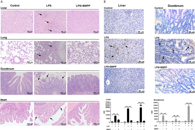 PLE inactivation attenuates tissue injury and the inflammatory response in vivo. (A) Pathological examination (H&E staining) of pig tissues. Pigs (n=3) were treated with sterile saline or LPS (25 µg/kg) or the combination of LPS and BNPP (25 mg/kg, i.p., given prior to 1 h of LPS induction). Then, tissue injuries were detected after 24 h. (B) Neutrophil infiltration was assessed by MPO staining (brown staining), and quantitative analysis was performed by CaseViewer software. Representative images are shown, and the black arrow shows the damage in the tissues. Integral optical density (IOD) is the value of the light absorbed or transmitted by the result of dye staining in different tissue cells under the same illumination condition. The numbers in the figures represent the corresponding pigs. Statistical significance was indicated by asterisks (**P < 0.01; ***P < 0.001).