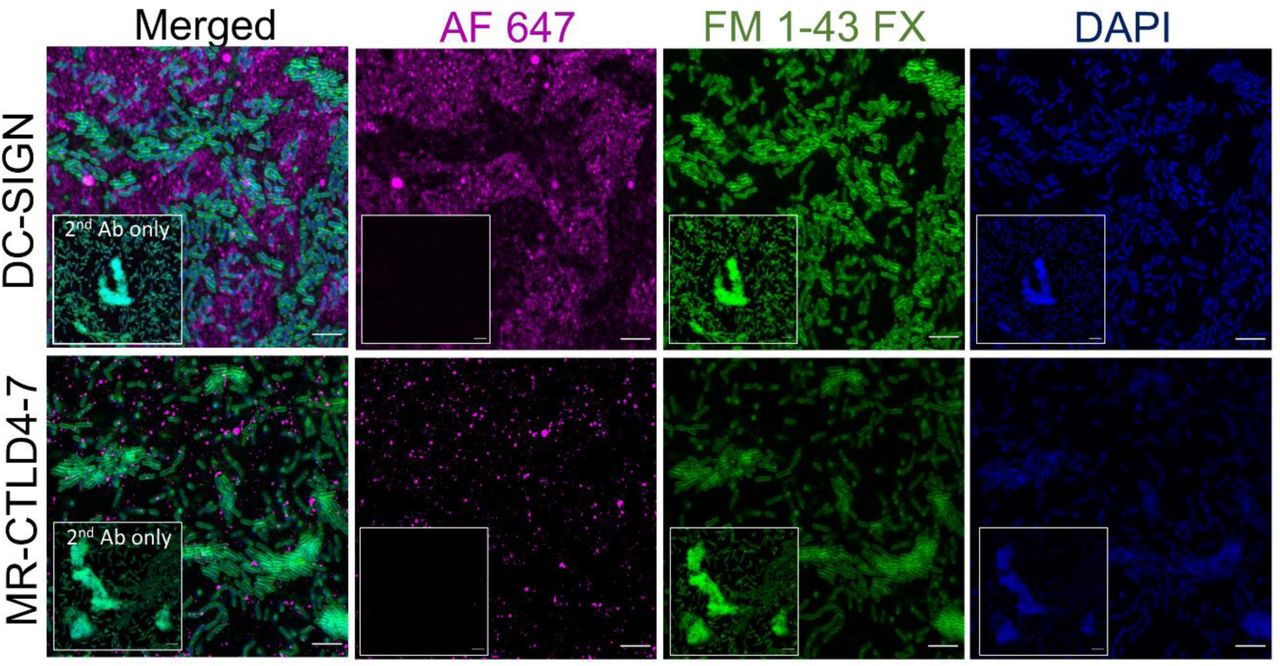 Distribution of MR and DC-SIGN ligands in P. aeruginosa biofilms.PAO1 biofilms generated under flow conditions for 18h as described in Figure S2 were incubated with DC-SIGN and MR-CTLD4-7 Fc-chimeric proteins followed by anti-human Fc-secondary antibody conjugated to Alexa 647 (magenta) and counterstained with DAPI (DNA, blue) and FM1-43FX (bacteria, green). Z-stacks were acquired for all samples using confocal microscopy (see videos S1 and S2). The top panels show slice 9 for DC-SIGN, and 12 for corresponding secondary Ab control (insets) and bottom panels slice 12 for MR-CTLD4-7 and its control (insets). The same settings for image acquisition and processing were maintained for test and control samples (Videos S3 and S4). Inset shows signal with biofilms incubated with secondary antibody only. No specific labelling was seen with MR-CR-FNII-CTLD1-3 Fc chimeric protein (video S5). Size bar 4 µm.
