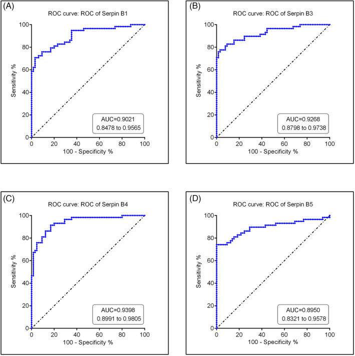 ROC curves of four SERPINBs’ clinical significance in peri‐implantitis. (A) SERPINB1, (B) SERPINB3 (C) SERPINB4 (D) SERPINB5 are analyzed by ROC curves and each SERPINBs represent the potential AUC