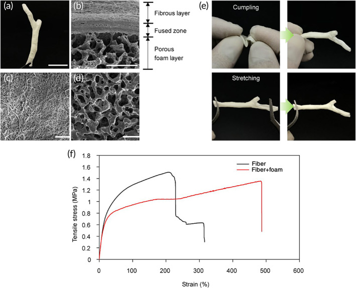 Characterization of 3D customized dual‐layer tubular scaffold. (a) Overall shape of the final scaffold. (b) Representative scanning electron microscopy (SEM) image of cross section through dual layer scaffold. (c) SEM image of inner surface of fiber layer. (d) SEM image of outer surface of porous foam layer. (e) Manual resilience tests by harsh crumpling and stretching. (f) Tensil testing of 3D scaffolds engineered as a dual layer or fiber‐only layer. Scale bars: 20 mm (a); 50 μm (b), 100 μm (c, d)