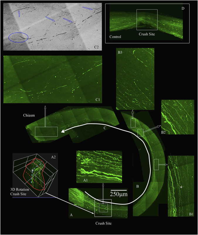 Four-drug treatment promotes robust axonal regeneration in the rat ONC model as detected by AAV8-GFP labeling. We labeled the regenerating axons with AAV8-GFP injected intra-vitreally to the RGC cell bodies 2 weeks prior to euthanizing. The optic nerves are immunolabeled by iDISCO with anti-GFP and then chemically cleared. (A) Crush site of the nerve of displaying regenerating fibers expressing GFP. The inner box is magnified in A1, displaying tortured growing axons in the center of the nerve (inner box with traced white arrow). A2, is a 3D rendering of the nerve at the crush site (outer white box in A shown by filled white arrow) that is rotated on its axis to emphasize regenerating axons are not growing on the edges but more in the center of the nerve (see asterisk). (B) Continuation of the nerve displaying GFP expressing axons that are growing in the center of the nerve and even crossing over in B1 (see asterisk). B2 and B3 are magnified regions with GFP labeled axons over 4 mm away from the crush site. (C) We detect GFP labeled axons growing into the chiasm of the nerve and the end of the chiasm, we have a magnified region in C1. The image in C1 was converted to grayscale and then inverted in C2, to emphasize the tortured growth into the chiasm as demarcated by the blue arrows and the bifurcation (blue circle in C2) of the axons growing into the chiasm. (D) An example of an adult rat that only received vehicle controls. No GFP labeled axons are displayed past the crush site. All images are taken on an Olympus Multiphoton microscope with a 25X water immersion lens. The images in A1, B1-3 and C1 are taken at 25x with a 1.5x Zoom. Micrometer of 250 microns is shown in (A).