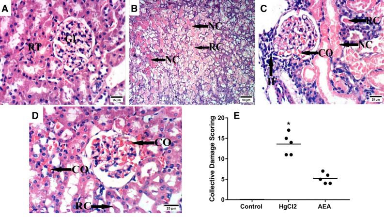 Effect of AEA on HgCl2-induced histopathology alterations. Microscopically, the section of the (A) normal control group reveals the normal histological architecture of renal parenchyma (normal renal tubules and glomeruli). In contrast, the sections of the (B,C) HgCl2-untreated rats show notable histopathological damage characterized by congestion of glomerular tufts, marked coagulative necrosis of epithelial lining renal tubules, renal cast in the lumen of renal tubules, and inflammatory cells infiltration. On the other hand, the section of the (D) AEA-treated group shows an improved picture with milder congestion of glomerular tufts and renal blood vessels as well as renal cast in the lumen of some renal tubules. All black arrows point to the altered structure in the section (scale bar = 25;50). Panel (E) illustrates the collective kidney damage score scatter blot; and data were analyzed using the Kruskal–Wallis test followed by Dunn’s post hoc test. Values were calculated from 5 fields of n = 3 rats/group; as compared with *P < 0.05 compared with CONT group. AEA anandamide, HgCl2 mercuric chloride.