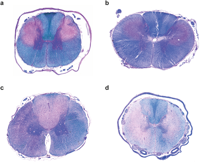 Phenotypic variability of transverse spinal cord sections of LEMP-affected dogs. Combined luxol fast blue/hematoxylin & eosin stain of paraffin sections. (a) Thoracic spinal cord of a Leonberger case L1 with typical LEMP lesions as previously described13. Note the bilateral-symmetrical loss of myelin in the corticospinal tracts as indicated by the loss of the blue color. (b) Cervical spinal cord of a previously described12 Rottweiler case R1 with similar lesions as in (a). This dog had severe white matter loss in some areas combined with axonal loss, infiltration by macrophages and capillary hypertrophy. (c) Thoracic spinal cord of Leonberger case L3. The quality of lesions is similar as in (a), but the distribution is different with lesions being most severe in the dorsal tracts. (d) Thoracic spinal cord of Rottweiler case R3 showing similar lesions, which are less defined and more widespread encroaching into lateroventral tracts.