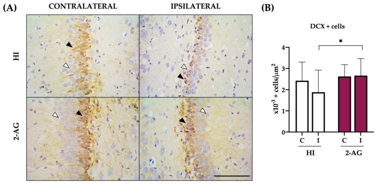 The presence of neuroblasts is more notable in 2-AG-treated animals than in non-treated HI ones at P14. (A) Representative microphotographs of DCX positive cells (black arrowhead) in the contralateral and ipsilateral SGZs of the hippocampus in both experimental groups. Positive cells appear stained in brown, as marked with the black arrowhead in the upper left image. Negative cells showed no brown staining, as marked with the white arrowhead in the upper left image. Images were taken at 40× magnification (Scale bar: 100 μm). (B) A reduced number of DCX+ cells was found in the ipsilateral SGZ of non-treated HI animals compared to the contralateral one, even though differences were not statistically significant. In 2-AG treated animals, no differences were found between the contralateral and ipsilateral SGZs. However, when comparing the ipsilateral SGZ of both experimental groups, 2-AG-treated animals showed significantly higher values of DCX+ cells (* p < 0.05) in comparison with non-treated HI rat pups.