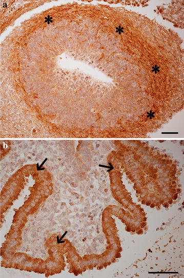Photomicrographs of the developing central nervous system focusing at the olfactory bulbs (a) and choroidal plexa (b). a asterisks indicate positive fibres in the developing olfactory cortex; b arrows indicate cytoplasmic immunostaining of choroidal plexa epithelial cells. Scale bars are equal to 50 µm
