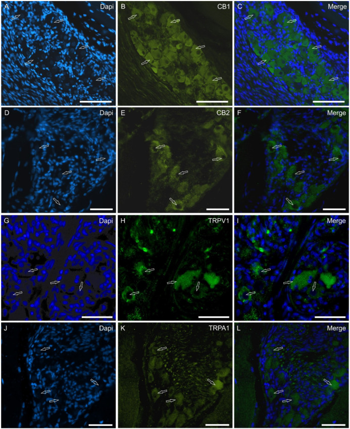 Photomicrographs showing cryosections of the piglet papillae vallatae in which large ganglia of lingual neurons exhibited bright CB1R (A–C), CB2R (D–F), TRPV1 (G–I) and TRPA1 (J–L) immunoreactivity (arrows). (C,F,I,L): merged images. Scale bar: 50 µm.