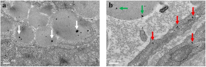 Distribution of triangular silver nanoplates in the intestinal vessels of mice with CBD ligation. a Triangular silver nanoplates located in the blood corpuscle (white arrows). b Triangular silver nanoplates penetrated into the vascular wall (green arrows), while some located in the blood corpuscle (red arrows)