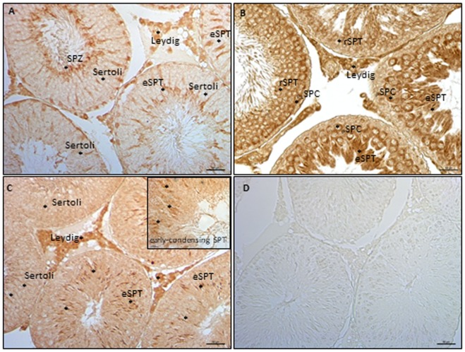 Immunocytochemistry analyses of endocannabinoid system components in testis from rat at 90 days post partum. Immunolocalization of NAPE-PLD (A), fatty acid amide hydrolase (B), and monoacylglycerol-lipase (C) proteins in interstitial and tubular compartments. Asterisks indicate immunopositive cells. Specificity of reaction was checked by omitting the primary antibody (D). Scale bar: 50 µm; inset scale bar: 10 µm.
