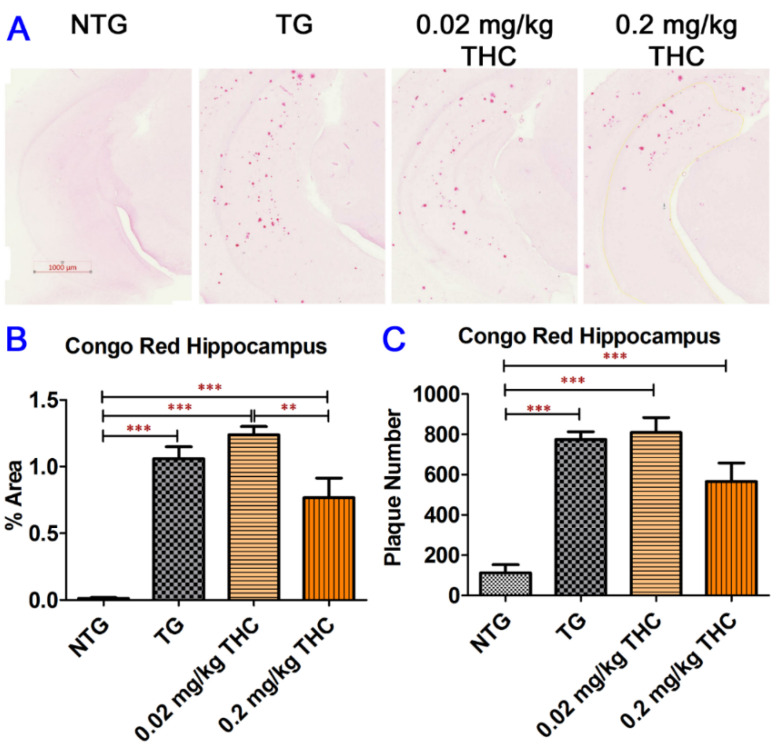 Congo Red staining of Aβ plaques in mouse hippocampi. (A) Representative Congo Red staining images acquired under light microscopy. (B) Quantification of Congo red staining shown as the percentage of Congo red-positive area compared to the hippocampus tissue area per field. (C) Quantification of Congo red staining shown as the number of Congo red stained plague in the hippocampus area. The non-transgenic (NTG) mice had significantly fewer Aβ plaques than all the APP/PS1 transgenic (TG) mice regardless of treatment (p < 0.001 for all). No significant differences in Aβ plaque area and number of Aβ plaques were found between the vehicle control and 0.02 or 0.2 mg/kg THC treated APP/PS1 mice. However, the Aβ plaque area in hippocampi sections of APP/PS1 mice treated with 0.2 mg/kg THC was significantly lower than those treated with 0.02 mg/kg THC (p < 0.01). Data are expressed as mean ± SD (N = 7 for the control NTG group, N = 6 for the control TG, and 0.2 mg/kg THC groups, and N = 8 for the 0.02 mg/kg THC group). Error bars denote the SD. ** p < 0.01 and *** p < 0.001 compared between the control NTG mice, control APP/PS1 mice, and APP/PS1 mice treated with 0.02 and 0.2 mg/kg THC using one-way ANOVA followed by the Tukey–Kramer post hoc multiple comparison test.