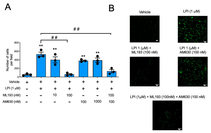 LPI-induced chemotaxis is mediated by GPR55, but not CB2 receptors in BMMCs. Panel (A): BMMCs were placed in the Boyden’s chamber to quantify migration towards LPI in the presence of ML193, AM630, or a combination of both antagonists. Data in graph are presented as the mean ± SEM of at least three independent experiments performed with distinct cell cultures; ** p < 0.01 vs. vehicle; ## p < 0.01 vs. LPI. Panel (B): representative image of a Boyden’s chamber experiment utilizing LPI (1 μM) alone or in the presence of ML193 (100 nM), AM630 (100 nM), or a combination of both antagonists (100 nM ML193 + 100 nM AM630). No significant difference was observed when the effect of ML193 alone was compared with the ML193 + AM630 group (p = 0.3704). Scale Bar = 20 μm.
