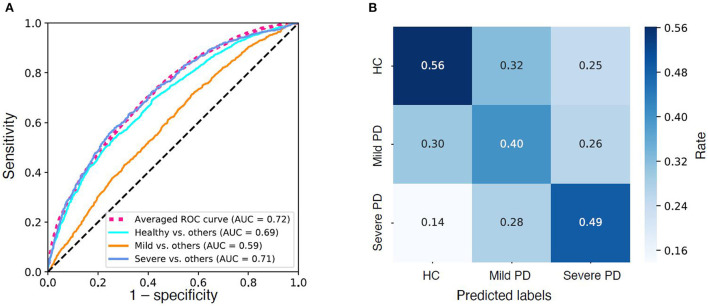 Model performance. (A) Receiver operator characteristic (ROC) curves of the three “one-vs.-rest” base predictive models and the average ROC curve of the combined multi-label predictive model. (B) Confusion Matrix of the predictive model. Color density indicates rate.