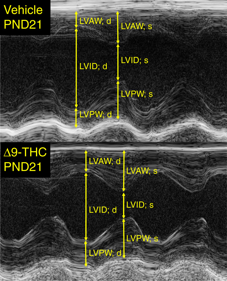 Representative echocardiogram from 3-week vehicle and 3-week-old rat offspring exposed to Δ9-THC. All animals were measured at postnatal day 21. LVAW left ventricular anterior wall, LVID left ventricular interior diameter, LVPW left ventricular posterior wall, d diastole, s systole.