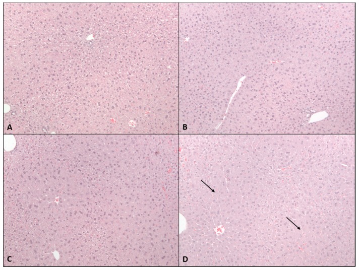 Effects of 2-week administration of CBD on liver histomorphology. H&E stained liver sections from (A) vehicle mice or those gavaged with (B) 61.5 mg/kg, (C) 184.5 mg/kg, or (D) 615 mg/kg CBD in sesame oil for 2 weeks. Note that 615 mg/kg group was terminated after 2–3 doses due to overt toxicity elicited by CBD.