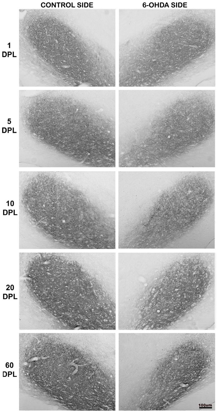 Temporal changes of CB1 expression in the SNpr of PD-induced rats.CB1 expression in the substantia nigra pars reticulata (SNpr) of rats submitted to unilateral intrastriatal injections of 6-OHDA after 1, 5, 10, 20 and 60 days post-lesion (DPL). Digital images of coronal sections of the SNpr show a decrease in the CB1 expression in the experimental side from 5 DPL to 60 DPL.