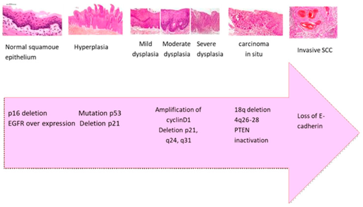 The transition from normal squamous epithelium to invasive SCC involves sequential morphological changes (including dysplasia, carcinoma in situ, and invasive carcinoma, magnification 400×) accompanied by key molecular events such as p16 deletion, EGFR overexpression, TP53 mutation, cyclin D1 amplification, and PTEN inactivation. These alterations cause malignant transformation, enhanced proliferation, and loss of cellular adhesion, particularly E-cadherin, contributing to tumor invasiveness and metastasis [23,46,47].