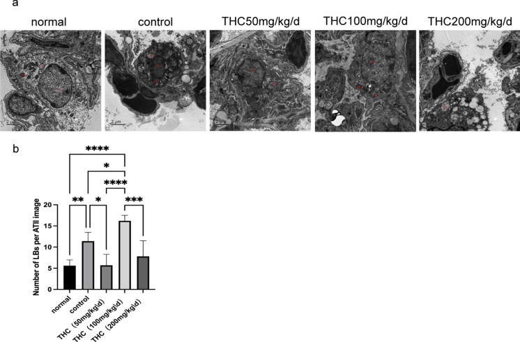 Electron microscopy of lung tissue from mice inoculated with C. deneoformans. a The ultrastructure of lung tissue and the invasion of Cryptococcus after treatment with THC.One sample were randomly selected from each group. The overview in a shows a well-preserved type II cell from a rat lung. Lamellar bodies (LB), nucleus (Nu) and mitochondria (Mt) are well preserved.Bars = 2 μm. b Analysis of LBs number within the alveolar epithelial type II cells( ATII).Values are expressed as mean ± SEM. (*p < 0.05, **p < 0.01, ***p < 0.001,****p < 0.0001), n = 5/group