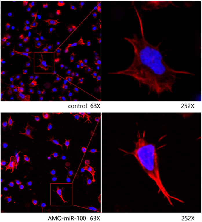 Confocal microscopy of shrimp hemocytes treated with AMO-miR-100.The filamentous actin was stained with rhodamine phalloidin and the cellular DNA with DAPI. Non-treated cells were used as controls. The amplification factor is 63 × (left) and 252 × (right).