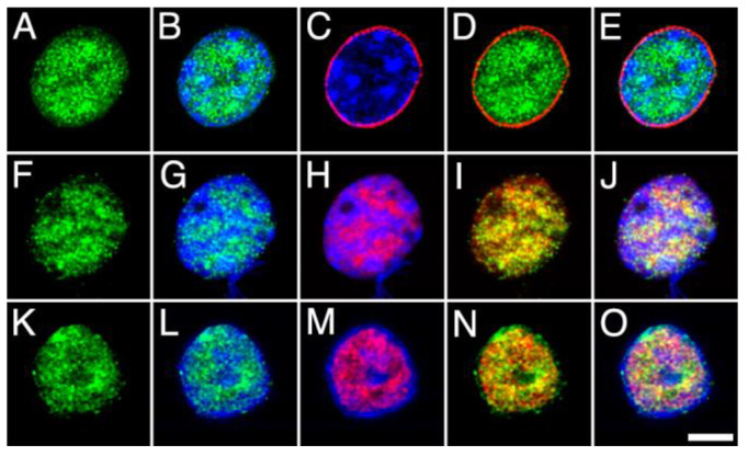 High-power micrographs of intact nuclei isolated from the adult rat brain cortex double stained with anti-MGL (green) combined with Hoechst staining (blue) and NPCx ((A–E); red), NeuN/Fox-3 ((F–J); red) and DGLα ((K–O); red) immunostaining. All micrographs are maximum intensity projections of three consecutive 0.24 µm-thick optical sections acquired in grayscale and pseudo colored. Scale bar = 5 µm in O (applies to (A–O)).