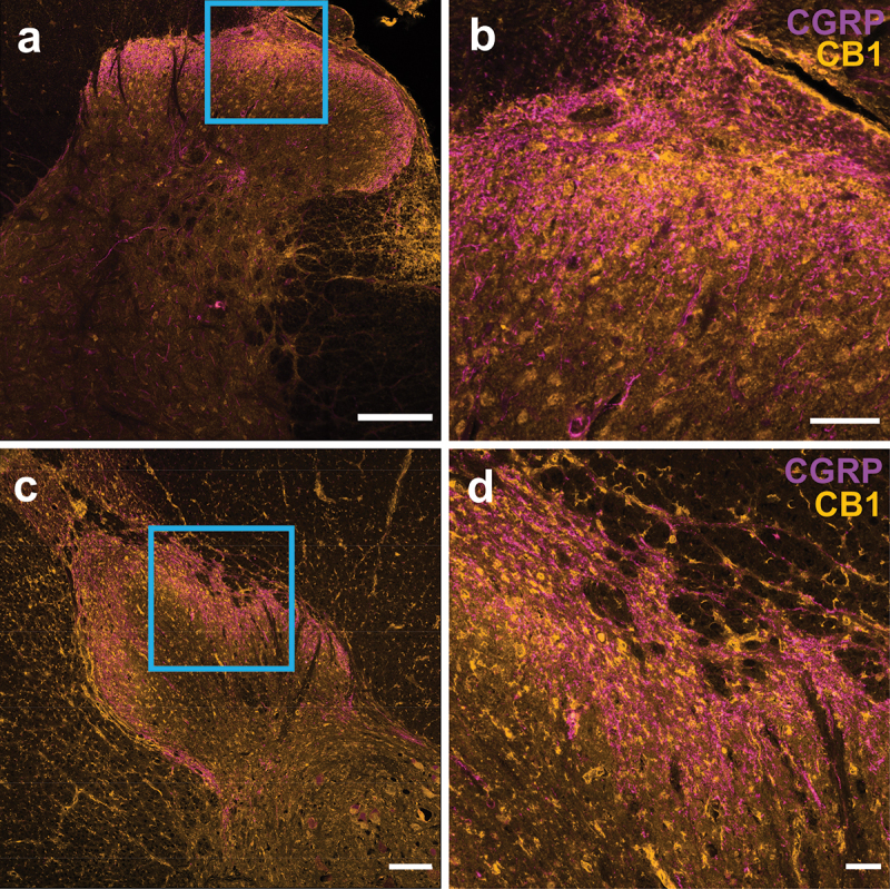 CB1 receptors are not primarily localized to peptidergic CGRP afferents. Overlay of CB1 receptor immunoreactivity (yellow) and CGRP immunoreactivity (purple) in (A), (B) rat and (C), (D) human spinal sections. A section of the SDH is shown at higher magnification (B), (D) to display localization patterns between CB1 and CGRP. Scale bar = 200 μm (A), (C). Scale bar = 50 μm (B), (D).