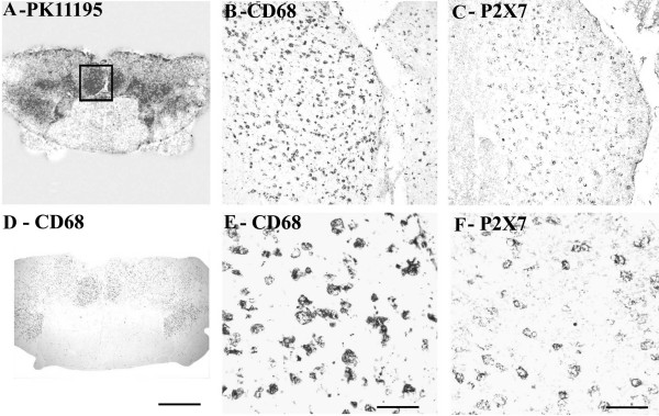 P2X7 immunoreactivity localised to microglial cell/macrophage-like cells in ALS spinal cord. (A) Autoradiographic localisation of 3 [H] PK11195 in a spinal cord from a patient with ALS co-located with CD68 (D) (Scale bars = 1000 μm). The square indicates the area where subsequent CD68 and P2X7 images were taken from. B) And E) Microglial-like immunostaining with CD68 antibody (Scale bars = 200 μm and 100 μm respectively). C) And F) microglial cell/macrophage-like immunostaining with P2X7 (Scale bars = 200 μm and 100 μm respectively).