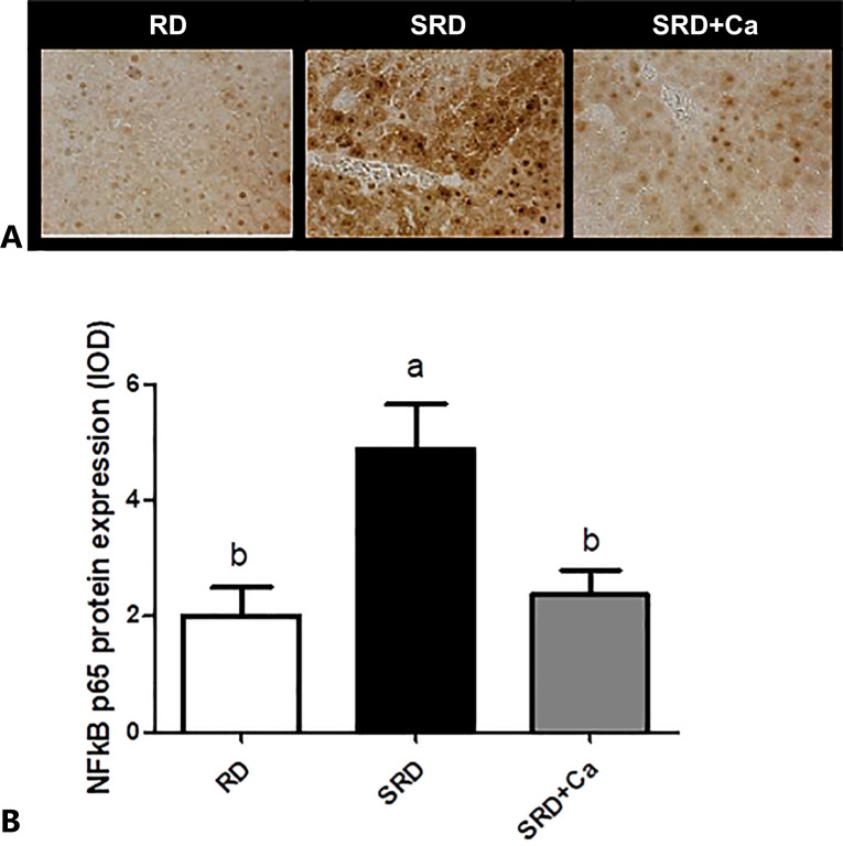Liver NF-κB p65 expression in rats fed a reference diet (RD), sucrose-rich diet (SRD), or SRD with cannabis oil (SRD + Ca). A Representative photomicrographs of immunocytochemical staining NF-κB in the liver sections of rats. Increased levels of nuclear and cytoplasmic positive markers are observed in the SRD group. ×400 magnification. B Quantitative immunohistochemical analysis of NF-κB p65 expression in the liver. Values (mean ± SEM, n = 6) are expressed as the integrated optical density (IOD). Values are expressed as mean ± SEM, n = 6. Bars that do not share the same letter are significantly different (p < 0.05) when one variable at a time was compared by one-way ANOVA followed by Newman-Keuls test.