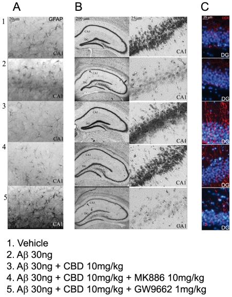 Effects of CBD on reactive gliosis, neuronal survival, and neurogenesis in rat hippocampi.A: representative photomicrographs of the CA1 area of rat hippocampus showing the results of immunohistochemical evaluation of GFAP. B: representative photomicrographs showing the results of Nissl staining of the whole rat hippocampus (2X magnification) and the corresponding CA1 region (10X magnification). C: immunofluorescence photomicrographs showing a particular (10X magnification) of DCX-labeled cells in the dentate gyrus (DG) of rat hippocampi.
