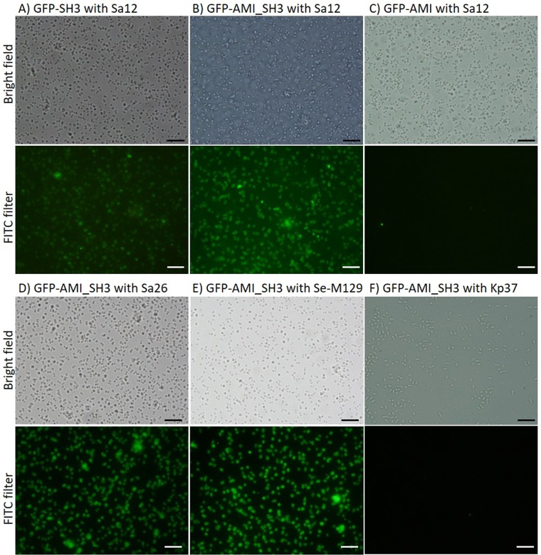 Fluorescence microscopy images of the different domains of E-LM12 endolysin and specificity assay of GFP-AMI_SH3. S. aureus Sa12 cells incubated with: GFP-SH3 (A), GFP-AMI_SH3 (B) and GFP-AMI (C). Assessment of the binding affinity of GFP-AMI_SH3 protein after incubation with: S. aureus Sa26 (D), Staphylococcus epidermidis M129 (E) and Klebsiella pneumoniae 37 (F). Observations were made in bright field and under FITC filter with the same exposure time to detect the presence/absence of fluorescing cells. Scale bar represents 10 µm.