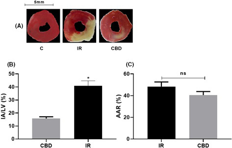 (A) Representative sections of the ring cross section of the left ventricle (LV) animals with ischemia 45 min and reperfusion and animals treated with CBD stained with triphenyltetrazolium chloride. (B) Graph of the area of infarct/left ventricle (IA/LV) in coronary occlusion groups for 45 min with subsequent reperfusion (n = 6). The values are the means ± SEM. *p < .001 CBD versus IR