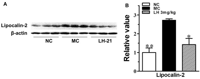 Impact of LH-21 on adipose tissue lipocalin-2 protein expression in KKAy mice. (A) Expression of lipocalin-2 in adipose tissue determined by western blot. (B) Quantification of the result in panel (A). NC, normal control; MC, model control; LH, LH-21. n = 3; values are mean ± SD, n = 3; *p < 0.05, **p < 0.01 vs. MC group.