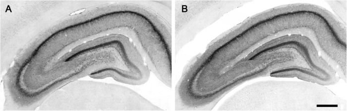 Micrographs of CB1-immunostaining in the hippocampal formation of lean (A) and obese (B) Zucker rats processed in parallel. Scale bar = 500 μm.
