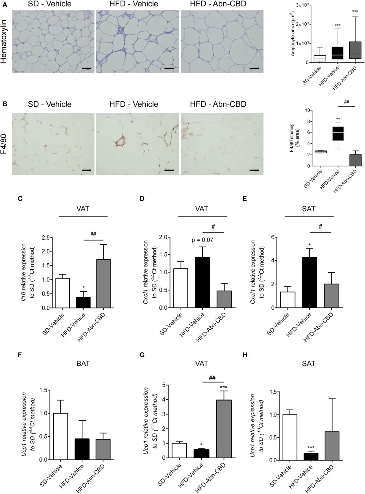 Effect of Abn-CBD on inflammation in white adipose tissue. Representative photomicrographs and quantification of (A) adipocyte size and (B) crown-like structures in white adipose tissue. Relative expression of (C) Il10 and (D) Cxcl1 in visceral adipose tissue and of (E) Cxcl1 in subcutaneous adipose tissue. Relative expression of Ucp-1 in (F) brown adipose tissue, (G) visceral adipose tissue, and (H) subcutaneous adipose tissue. β-actin was used as reference gene. *p ≤ 0.05, **p ≤ 0.01, and ***p ≤ 0.001 compared to SD-Vehicle; #p ≤ 0.05 and ##p ≤ 0.01 compared to HFD-Vehicle.
