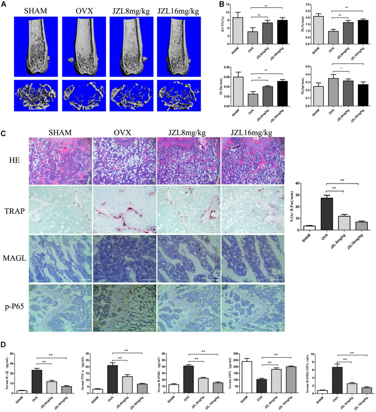 JZL184 ameliorates OVX-induced bone loss in vivo. Forty female C57BL/6 mice (12 weeks of age) were randomly divided into four groups: sham group (n = 10), OVX group (n = 10), OVX + JZL low-dose group (n = 10), and OVX + JZL high-dose group (n = 10). (A) The right femurs of all mice were scanned using high-resolution μCT, and representative 3D μCT reconstructed images are shown (scale bar = 1.00 mm) (n = 10). (B) Graphical representation of bone structural parameters, including bone volume/tissue volume (BV/TV), trabecular thickness (Tb.Th), trabecular number (Tb.N), and trabecular separation (Tb.Sp), are shown. (C) Sections of the left femurs of all mice were stained with H&E (scale bar = 400 μm), TRAP (scale bar = 200 μm), MAGL (scale bar = 200 μm), and p-P65 (scale bar = 400 μm). The number of osteoclasts per field of tissue (No. Oc/B.Pm) was counted. (D) Serum concentrations of RANKL, OPG, TNF-α, and IL-1β were measured. Data are presented as means ± SD. *P < 0.05, **P < 0.01 vs. the OVX group.