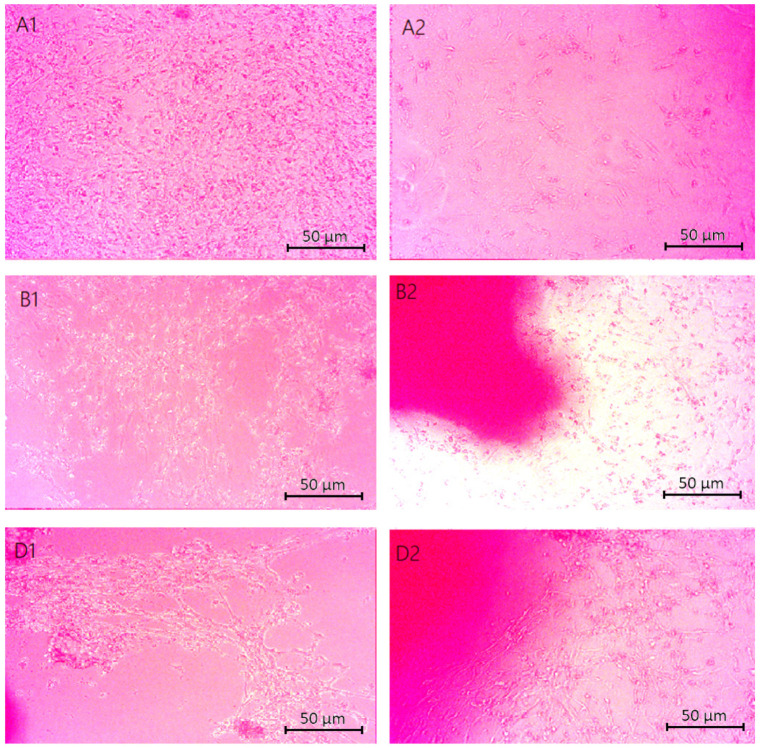 Microscopic images (40× magnification) of chitosan biomaterials modified with poly(dopamine) NPs cytotoxicity results performed on nerve cells (astrocytes): (A1,A2) Asp:Glu 0.84:0), (B1,B2) Asp:Glu 0.5:0.5 (D1,D2) Asp:Glu 0.3:0.7.