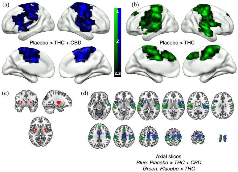 Drug effects on brain-wide connectivity with the sensorimotor striatum in study 1. Contrasts are placebo > active drug. Clusters represent a significant decrease in functional connectivity with the sensorimotor striatum in the active drug conditions. (a) Significant clusters (blue) in the placebo > THC + CBD comparison on 3D cortical renders. (b) Significant clusters (green) in the placebo > THC comparison on 3D cortical renders. (c) The sensorimotor striatum seed-region. (d) Significant clusters in both comparisons ((a) and (b); same colours) overlaid together on axial slices.