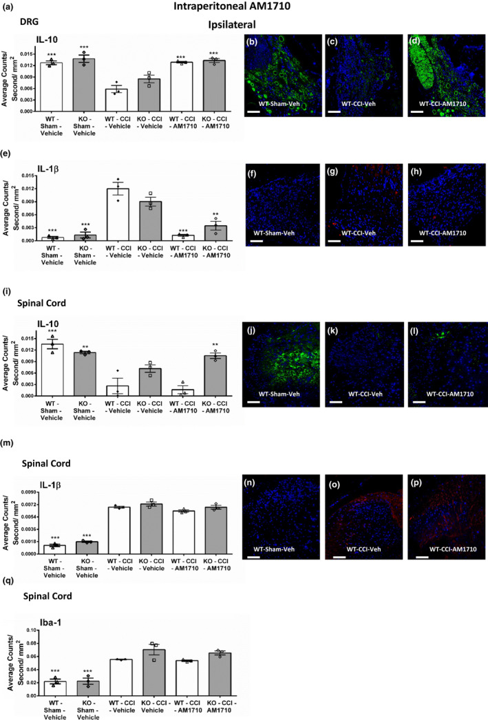 Ipsilateral immunofluorescent intensity quantification of tissues following intraperitoneal AM1710. Ipsilateral immunofluorescent intensity quantification from 7‐µm‐thick sections of DRG and dorsal horn spinal cord from behaviorally verified CB1R KO, Het, WT mice, following i.p. vehicle or AM1710. (a) IL‐10 expression in DRG was decreased in CCI‐treated mice that received i.p. vehicle compared to control sham‐treated mice given AM1710, while IL‐10 IR recovered to sham levels in CCI neuropathic mice given i.p. AM1710. (b, c, d) Representative spectrally unmixed images at 20x magnification of IL‐10 fluorescent labeling (green) with DAPI nuclear stain (blue) in DRG. (e) Compared to sham controls, IL‐1β expression was increased in the DRG of CCI‐treated animals given i.p. vehicle of AM1710. However, i.p. AM1710 in CCI‐treated mice robustly suppressed increases in IL‐1β IR. (f, g, h) Representative spectrally unmixed images at 20x magnification of IL‐1β fluorescent labeling (red) with DAPI nuclear stain (blue) in DRG. (i) IL‐10 expression in dorsal horn spinal cord was decreased in CCI‐treated mice that received i.p. vehicle compared to control sham‐treated mice given AM1710, and IL‐10 IR remained unchanged at neuropathic levels in CCI neuropathic mice given i.p. AM1710. (j, k, l) Representative spectrally unmixed images at 20x magnification of IL‐10 fluorescent labeling (green) with DAPI nuclear stain (blue) in spinal cord dorsal horn. (m) Compared to sham controls, IL‐1β expression was increased in the dorsal horn spinal cord of CCI‐treated animals given i.p. vehicle of AM1710. Intraperitoneal AM1710 in CCI‐treated mice did not alter increases in IL‐1β IR. (n, o, p) Representative spectrally unmixed images at 20x magnification of IL‐1β fluorescent labeling (red) with DAPI nuclear stain (blue) in spinal cord dorsal horn. (q) Iba‐1 IR expression increased within the ipsilateral dorsal horn of the spinal cord following CCI manipulations compared to control sham treatment, irrespective of i.p. vehicle or AM1710. ***p < .0001, **p < .001, *p < .05 versus. WT‐CCI‐Vehicle. Data reflect mean ± SEM, n = 3 mice per group