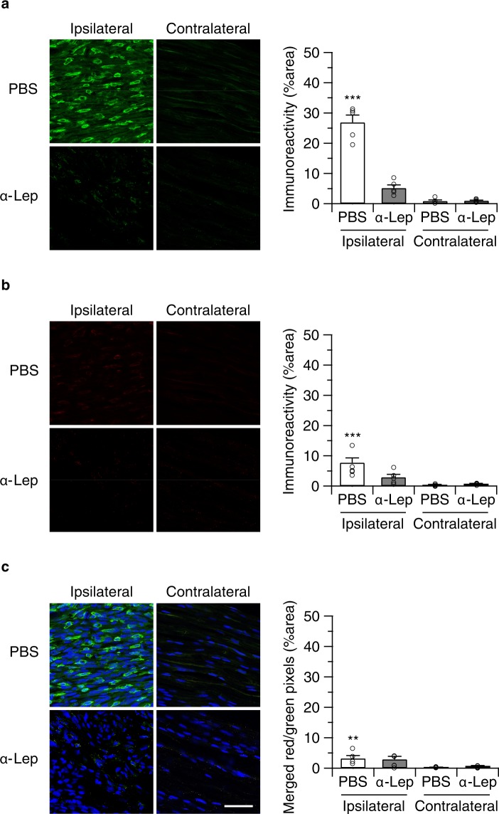 Perineurally administered leptin-neutralizing antibodies (20 ng/mouse/day) inhibited nerve injury-induced macrophage infiltration. Macrophage infiltration (a) as well as leptin receptor expression (b) was determined by immunohistochemistry 14 days after the surgery (24 hours after the final drug treatment). Bars indicate a length of 50 μm. (c) Merged images (green: F4/80, red: leptin receptor, blue: DAPI) showed that most of infiltrated macrophages in WT animals did not express leptin receptors. Quantified immunoreactivity is expressed as percentage of positive signals to the stained area (mean ± SEM). A significant treatment effect is indicated by **p < 0.01 or ***p < 0.001, compared with respective contralateral immunoreactivity (two-way ANOVA followed by Sidak’s multiple comparisons test), n = 5.