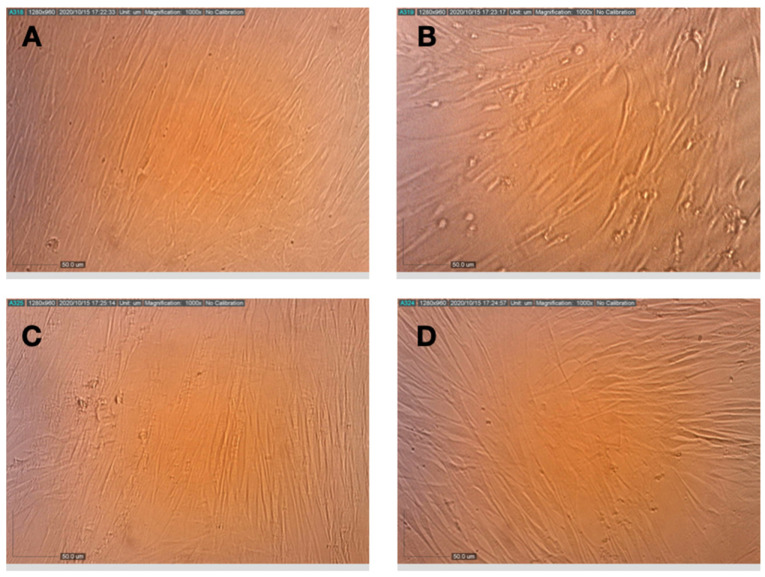 Effect of pretreatment of HCoV-229E with terpenes and CBD on its replication and cytopathic effect in MRC-5 cells. (A) Healthy MRC-5 cells, (B) MRC-5 cells at 72 h after infection with HCoV-229E that had been pretreated with assay medium, (C) MRC-5 cells at 72 h after infection with HCoV-229E that had been pretreated with terpenes and(D) MRC-5 cells at 72 h after infection with HCoV-229E that had been pretreated with terpenes and CBD.