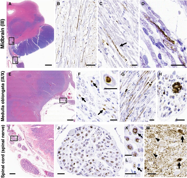 Representative photomicrographs of tau pathology in the PNS in progressive supranuclear palsy. (A–D) In the midbrain (A), phosphorylated tau deposits are evident in the oculomotor nerves: III, intra-medullary fibres (B: high magnification image of black box ‘b’ in A) and extra-medullary fibres [C: high magnification image of black box ‘c’ in A; arrow: phosphorylated-tau (p-tau) deposits; and D]. (E–H) In the medulla oblongata (E), tau accumulates in the glossopharyngeal/vagus nerves: IX/X, cross sections (F: high magnification image of black box ‘f’ in E; arrows: p-tau deposits; enlarged image in the top right corner) and sagittal sections (G). Occasionally, large inclusions with fibrillary morphology are also seen (H). (I–M) There are massive amounts of p-tau deposits in the spinal anterior roots [progressive supranuclear palsy (PSP) Case 1; J: high magnification image of black box ‘j’ in I; and K: high magnification image of ‘J’, arrow: p-tau deposits primarily located externally) and small amounts of p-tau deposits in the posterior roots (L, arrow; PSP Case 3) at the cervical cord level. (M) Tau pathology is also evident in the anterior horn of the cervical cord, PSP Case 1 (arrow: neurofibrillary tangle-like inclusions; and arrowhead: pre-tangle-like inclusions). (A–C) PSP Case 15, (D, G–K and M) PSP Case 1, (E and F) PSP Case 11 and (L) PSP Case 3. (A, E and I) Luxol fast blue/haematoxylin and eosin (LFB/H&E) and (B–D, F–H and J–M) AT8. Scale bars in A = 2 mm, B and M = 50 μm, C, D, F–H, J and L = 20 μm, E = 1 mm, I = 200 μm and K and enlarged image of the top right corner in F = 10 μm.