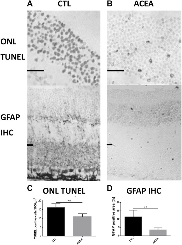 Treatment with ACEA decreased the number of apoptotic nuclei and GFAP-immunoreactive areas. (A): Representative TUNEL stained sections of the outer nuclear layer (ONL) of the retina of a CTL eye (Left) and an ACEA-treated eye (Right). Observe the higher amount of apoptotic nuclei in the CTL eye compared to the ACEA-treated eye. Scale bar: 20 μm. (B): Representative GFAP immunostained retinal sections of a CTL eye (Left) and an ACEA-treated eye (Right). A greater immunoreactivity of Müller cells is observed in the retina of the CTL eye compared to ACEA eye. (C): Quantification of ONL TUNEL positive cells. (D) Quantification of positive GFAP immunostained area. **p < 0.01.