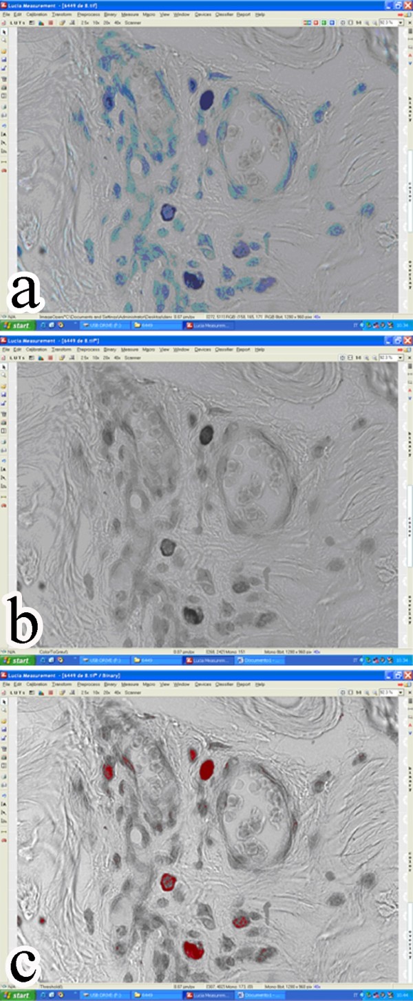 Densitometry procedure. a) Initial Toluidine blue stained captured image; b) binary (gray scale) image; c) red areas indicate measured granules.