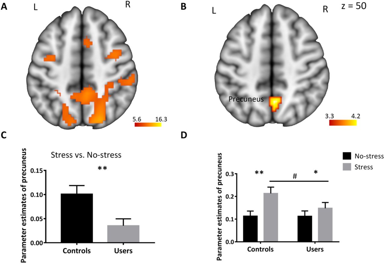 Stress-related network in the entire sample (A) and differences between cannabis users and controls (B) showing that cannabis users exhibited decreased precuneus activity during psycho-social stress. Extracted parameter estimates from the precuneus for the contrasts (stress > no-stress) (C) and (no-stress vs baseline, stress vs baseline) (D) further revealed that the effect was driven by lower activity during the stress condition. Image (A) is thresholded at p < 0.05, family-wise error corrected (FWE). Image (B) is thresholded at pFWE < 0.05, small volume correction. Error bars reflect the SEM. *p < 0.05. **p < 0.01. # p = 0.088. Laterality [left (L), right (R)].