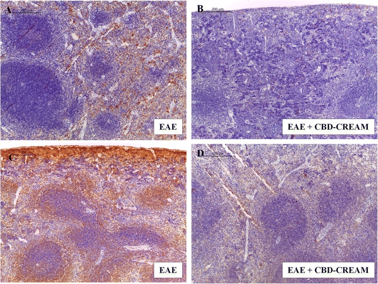 Immunohistochemical analysis for CD4 in spleen tissues from EAE mice (a:10x, A1 magnification:40x) and mice treated with 1 % CBD-cream (b:10x, B1 magnification:40x). Immunohistochemical image for CD8α localization of EAE mice (c:10x, C1 magnification:40x) compared to CBD topical treated mice (d:10x, D1 magnification:40x) in spleen tissues