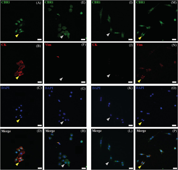 CBR1 (CBR1‐green) confocal microscopic results, showing images of equine primary skin‐derived cultures of keratinocytes (A‐H) and fibroblasts (I‐P). CBR1 immunoreactivity in keratinocytes (A and E) and fibroblasts (I and M). For keratinocyte and fibroblast immunophenotyping, co‐labeling of CBR1 with specific epithelial pan‐cytokeratin (CK‐red) (B) and fibroblast vimentin (Vim‐red) (N) markers was performed (yellow arrows indicate double positive cells). Inverse staining of Vim‐red on keratinocytes (F) and CK‐red on fibroblast (J) with CBR1 was additionally performed to distinguish both primary cell types (gray arrows indicate single positive cells). The DAPI (blue) was used for cell nucleus counterstaining; images were taken under 40x magnification; scale bars = 20 μm