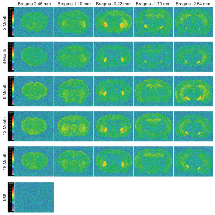 Computer-enhanced color autoradiograms of [3H] CP55940 (10nM) binding to CB1 receptors in coronal brain sections of 2-, 6-, 9-, 12- and 18-month-old C57BL/6J mice. Coronal brain sections are represented at the level of the prelimbic cortex (column 1; Bregma +2.46 mm), striatum (column 2; Bregma +1.10 mm), lateral geniculate nucleus (column 3; Bregma −0.22 mm), hippocampus (column 4; Bregma −1.70 mm) and lateral entorhinal cortex (column 5; Bregma −2.54 mm). Adjacent sections were incubated with 10 μm CP55940 to determine non-specific binding (NSB). Binding levels are represented using pseudo-color interpretation of black and white film images in fmol/mg of tissue equivalent.